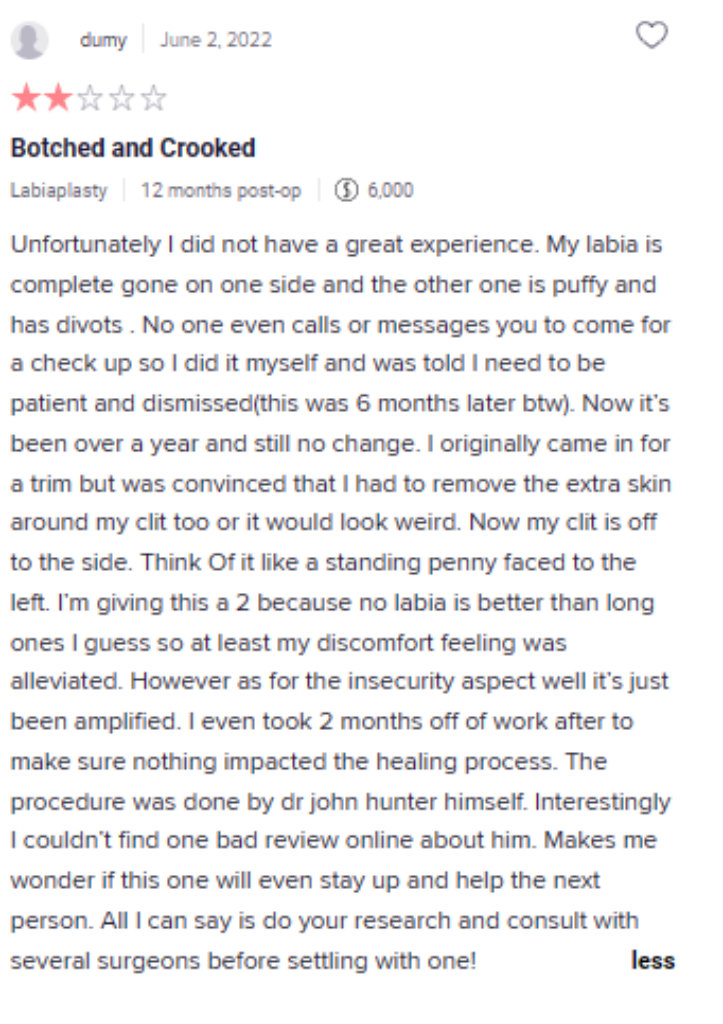 labiaplasty center of nyc review